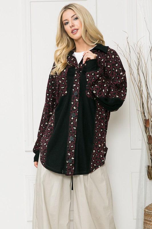 Oversized Elbow Patch Shacket - Jacket